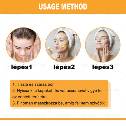 ADNOON® 🌼 🌼 Botox & Méregméz Feszesítő Krém - a bőr gyors regenerációját támogatja, a Magyar Bőrgyógyászati Társaság (MBT) által ajánlott 👨‍⚕️