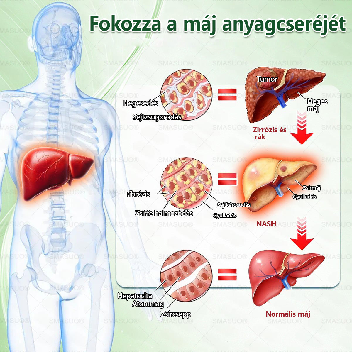 ✨Európai egészségügyi előírásoknak megfelelő · 👩‍⚕️Orvosi szakértők által ajánlott termék| 🎁 SMASUO® Glumasetide 8 az 1-ben Karcsú és Egészséges Nano Mikrotűs Tapasz