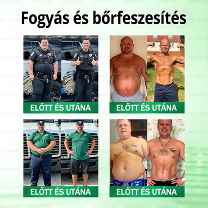 ✨Európai egészségügyi előírásoknak megfelelő · 👩‍⚕️Orvosi szakértők által ajánlott termék| 🎁 SMASUO® Glumasetide 8 az 1-ben Karcsú és Egészséges Nano Mikrotűs Tapasz