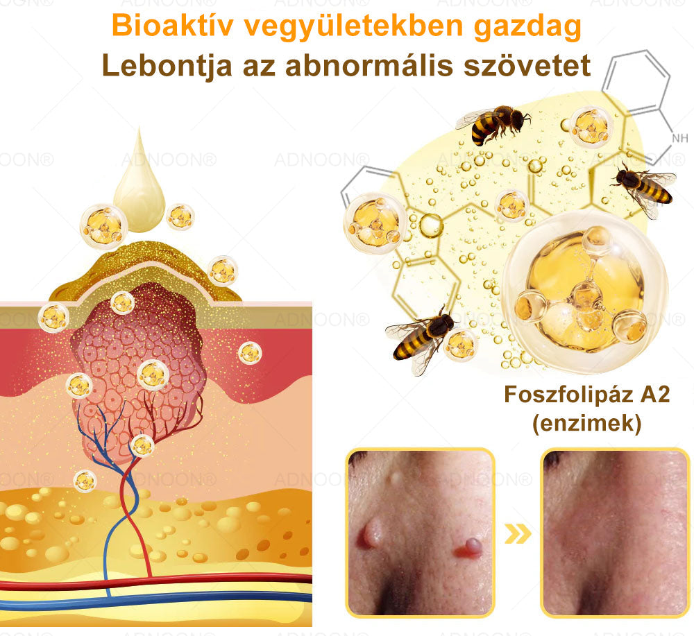 ADNOON® 🌼 🌼 Botox & Méregméz Feszesítő Krém - a bőr gyors regenerációját támogatja, a Magyar Bőrgyógyászati Társaság (MBT) által ajánlott 👨‍⚕️