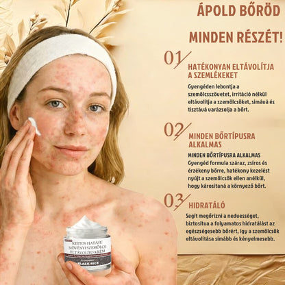 ✅ 𝙎𝙈𝘼𝙎𝙐𝙊® Fekete Rizses Bőrregeneráló Krém 👨‍⚕️ (Szemölcsök, bőrkinövések, foltok és hiperpigmentáció kezelésére)🍀