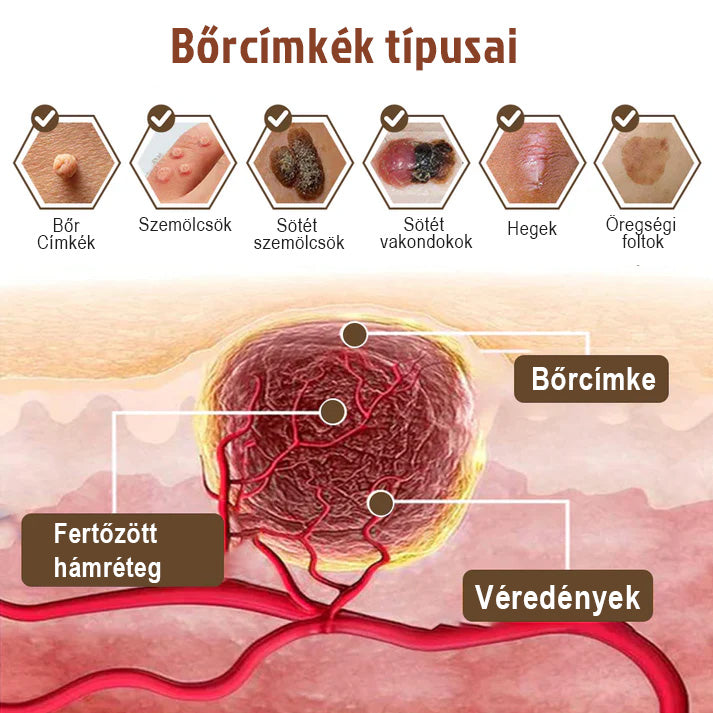 ✅ 𝙎𝙈𝘼𝙎𝙐𝙊® Fekete Rizses Bőrregeneráló Krém 👨‍⚕️ (Szemölcsök, bőrkinövések, foltok és hiperpigmentáció kezelésére)🍀
