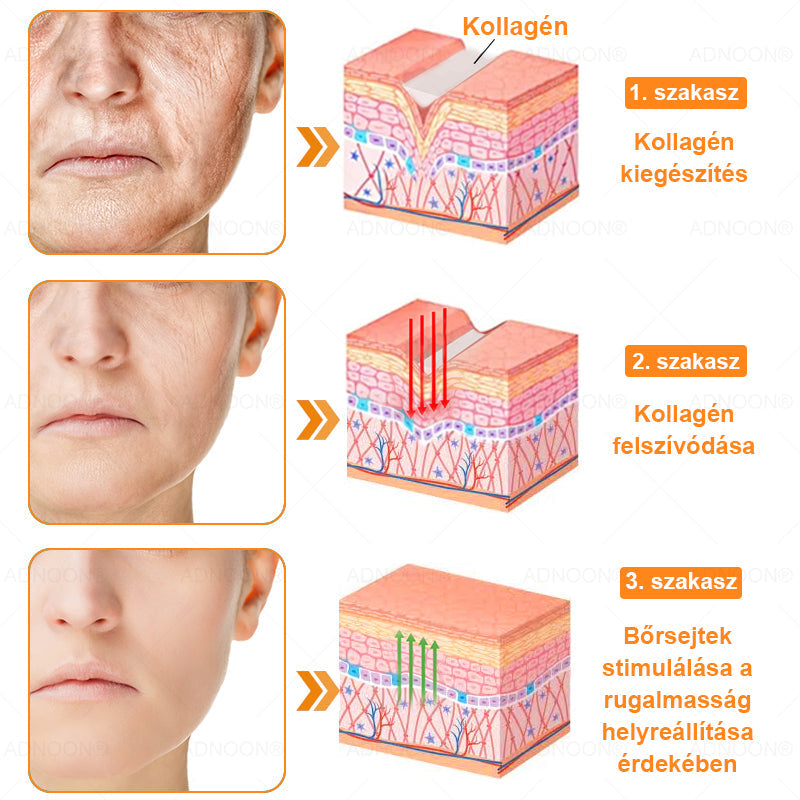ADNOON® 🌼 🌼 Botox & Méregméz Feszesítő Krém - a bőr gyors regenerációját támogatja, a Magyar Bőrgyógyászati Társaság (MBT) által ajánlott 👨‍⚕️