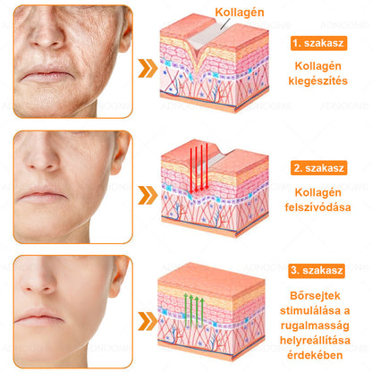 ADNOON® 🌼 🌼 Botox & Méregméz Feszesítő Krém - a bőr gyors regenerációját támogatja, a Magyar Bőrgyógyászati Társaság (MBT) által ajánlott 👨‍⚕️