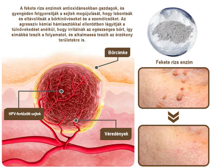 ✅ 𝙎𝙈𝘼𝙎𝙐𝙊® Fekete Rizses Bőrregeneráló Krém 👨‍⚕️ (Szemölcsök, bőrkinövések, foltok és hiperpigmentáció kezelésére)🍀