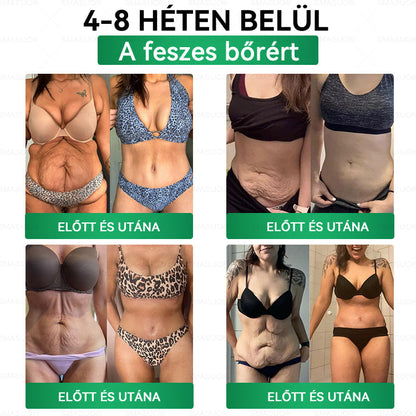 🌟Korlátozott készlet! A SMASUO® 🎁 további 30% kedvezményt kínál! Helyezze vissza testét és egészségét. Cselekedjen most – ez a lehetőség nem tart sokáig.